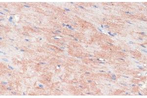 Immunohistochemistry of paraffin-embedded Rat heart using RPIA Polyclonal Antibody at dilution of 1:100 (40x lens). (Ribose 5-Phosphate Isomerase A (RPIA) 抗体)