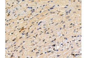 Phospho-MKK3/MKK6 (Ser189/Thr193) Antibody at 1/100 staining Rat heart tissue by IHC-P.