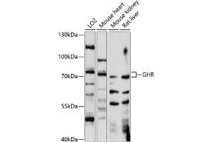 Western blot analysis of extracts of various cell lines, using GHR antibody (ABIN7267519) at 1:1000 dilution. (Growth Hormone Receptor 抗体  (AA 26-260))