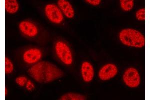 ABIN6267073 staining lovo cells by ICC/IF. (CHEK1 抗体  (pSer280))
