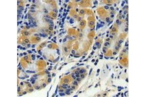 Used in DAB staining on fromalin fixed paraffin-embedded stomach tissue (CPN2 抗体  (AA 249-540))