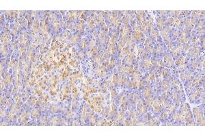 Detection of ELA3A in Human Pancreas Tissue using Polyclonal Antibody to Elastase 3A (ELA3A) (Elastase 3A 抗体  (AA 16-270))