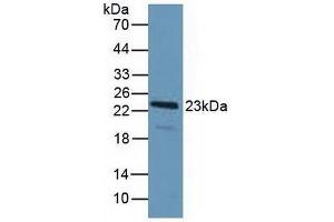 Western blot analysis of Human HeLa cells. (PDCD6 抗体  (AA 32-191))