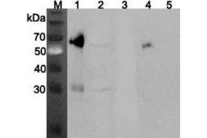 Western blot analysis using anti-ANGPTL3 (mouse), pAb  at 1:2'000 dilution. (ANGPTL3 抗体)