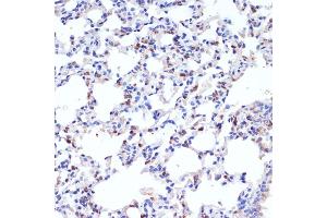 Immunohistochemistry (IHC) image for anti-Surfactant Protein C (SFTPC) (AA 1-197) antibody (ABIN3015598)