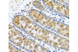 Immunohistochemistry of paraffin-embedded Human colon using GOT1 Polyclonal Antibody at dilution of 1:100 (40x lens). (GOT1 抗体)