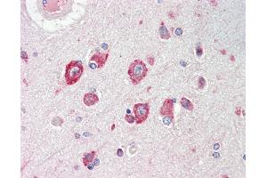 Anti-CACNG8 antibody IHC staining of human brain, cortex. (CACNG8 抗体  (AA 90-119))
