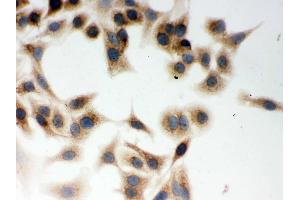 IHC analysis of CLOCK using anti-CLOCK antibody . (CLOCK 抗体  (N-Term))
