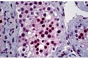 Human, Testis: Formalin-Fixed Paraffin-Embedded (FFPE) (YY1 抗体  (AA 221-321))