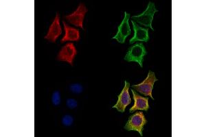 ABIN7094805 and ABIN7098856 staining Hela cells by IF/ICC.