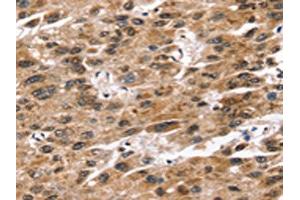 Immunohistochemistry (IHC) image for anti-Syntrophin, alpha 1 (Dystrophin-Associated Protein A1, 59kDa, Acidic Component) (SNTA1) antibody (ABIN7192580)