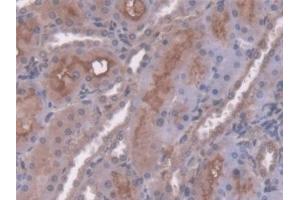 Detection of AT in Rat Kidney Tissue using Polyclonal Antibody to Antithrombin (AT) (SERPINC1 抗体  (AA 33-465))