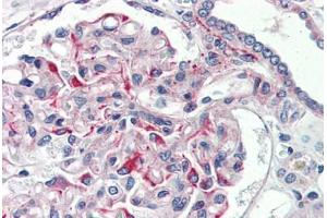 Human Kidney (formalin-fixed, paraffin-embedded) stained with JAG1 antibody ABIN337168 at 5 ug/ml followed by biotinylated goat anti-rabbit IgG secondary antibody ABIN481713, alkaline phosphatase-streptavidin and chromogen. (JAG1 抗体  (AA 110-125))