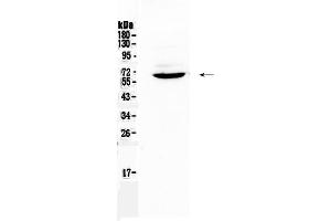 Western blot analysis of Heparanase 1 using anti-Heparanase 1 antibody . (HPSE 抗体  (AA 206-457))