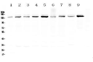 Western blot analysis of HAUSP/USP7 using anti-HAUSP/USP7 antibody . (USP7 抗体  (AA 258-483))