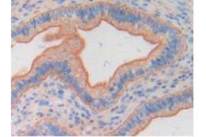 Figure. (FGF6 抗体  (AA 39-208))