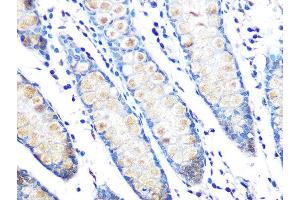 Immunohistochemistry of paraffin-embedded human colon using MUC2 Rabbit mAb (ABIN7268689) at dilution of 1:100 (40x lens). (MUC2 抗体)