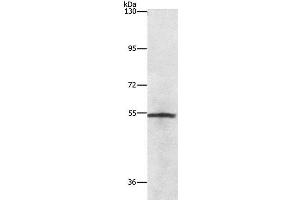 Western Blot analysis of Lovo cell using NEK2 Polyclonal Antibody at dilution of 1:727 (NEK2 抗体)