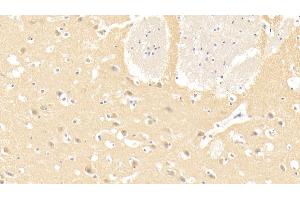 Detection of LAMa3 in Human Cerebrum Tissue using Monoclonal Antibody to Laminin Alpha 3 (LAMa3) (LAMA3 抗体  (AA 47-296))