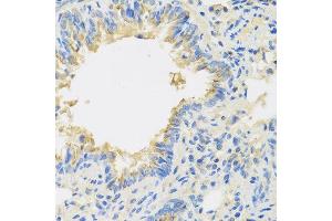 Immunohistochemistry of paraffin-embedded mouse lung using IL22 antibody at dilution of 1:100 (40x lens). (IL-22 抗体)