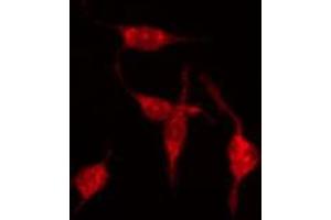 ABIN6273889 staining Hela by IF/ICC. (GPR68 抗体  (Internal Region))