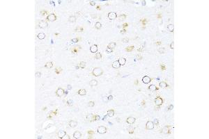 Immunohistochemistry (IHC) image for anti-DnaJ (Hsp40) Homolog, Subfamily B, Member 11 (DNAJB11) (AA 89-358) antibody (ABIN6139703)