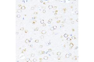 Immunohistochemistry of paraffin-embedded rat brain using DN antibody (ABIN6127810, ABIN6139703, ABIN6139704 and ABIN6216724) at dilution of 1:100 (40x lens). (DNAJB11 抗体  (AA 89-358))