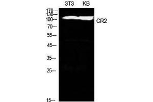 Western Blot (WB) analysis of NIH-3T3, KB cells using CD21 Polyclonal Antibody. (CD21 抗体  (Internal Region))