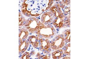 Immunohistochemistry (Paraffin-embedded Sections) (IHC (p)) image for anti-Phenylalanine Hydroxylase (AA 127-161) antibody (ABIN1944892)