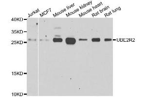 Western blot analysis of extracts of various cell lines, using UBE2R2 antibody. (UBE2R2 抗体  (AA 1-238))