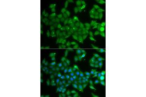 Immunofluorescence analysis of A549 cells using ANXA11 antibody. (Annexin A11 抗体  (AA 276-505))
