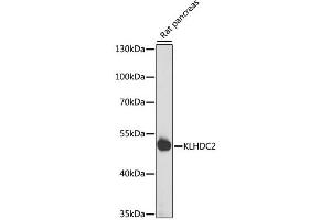 Western blot analysis of extracts of rat pancreas, using KLHDC2 antibody. (KLHDC2 抗体)