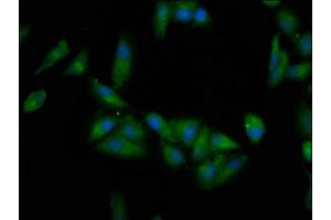 Immunofluorescence staining of Hela cells with ABIN7145566 at 1:200, counter-stained with DAPI. (EPRS 抗体  (AA 1207-1399))