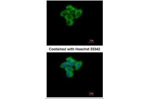 ICC/IF Image Immunofluorescence analysis of paraformaldehyde-fixed A431, using SENP2, antibody at 1:500 dilution. (SENP2 抗体  (N-Term))