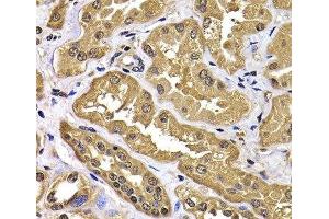 Immunohistochemistry of paraffin-embedded Human kidney using WBSCR22 Polyclonal Antibody at dilution of 1:100 (40x lens). (WBSCR22 抗体)