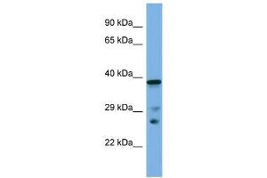 Host:  Rabbit  Target Name:  Lhx8  Sample Type:  Mouse Small Intestine lysates  Antibody Dilution:  1. (LHX8 抗体  (C-Term))