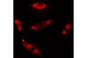 ABIN6275437 staining HuvEc cells by IF/ICC. (Rabenosyn 5 抗体  (Internal Region))