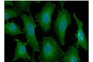 ICC/IF analysis of PDCP1 in HeLa cells line, stained with DAPI (Blue) for nucleus staining and monoclonal anti-human PDCD1 antibody (1:100) with goat anti-mouse IgG-Alexa fluor 488 conjugate (Green).