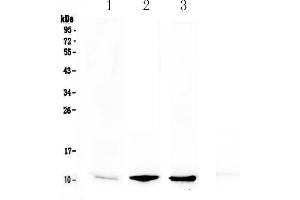 Western blot analysis of NAP2 using anti-NAP2 antibody .