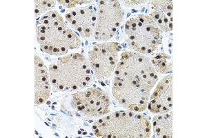 Immunohistochemistry of paraffin-embedded human stomach using EIF4G2 antibody (ABIN5971499) (40x lens). (EIF4G2 抗体)