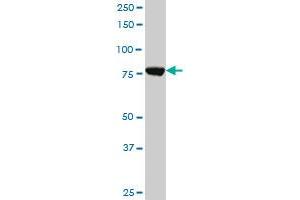 Western Blotting (WB) image for anti-Cleavage and Polyadenylation Specific Factor 3, 73kDa (CPSF3) (AA 585-684) antibody (ABIN526864)