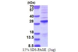 SDS-PAGE (SDS) image for Synovial Sarcoma, X Breakpoint 2 (SSX2) (AA 1-188) protein (His tag) (ABIN6387445) (SSX2 Protein (AA 1-188) (His tag))