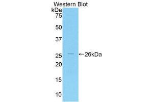 Western Blotting (WB) image for anti-Interleukin-1 Receptor-Associated Kinase 3 (IRAK3) (AA 201-410) antibody (ABIN1859470)