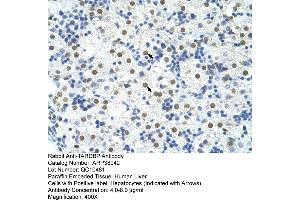 Human Liver (TARDBP 抗体  (C-Term))