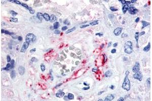 Human Placenta, Fetal Capillary Endothelial Cells (formalin-fixed, paraffin-embedded) stained with FLT1 antibody ABIN213617 at 5-10 ug/ml followed by biotinylated goat anti-rabbit IgG secondary antibody ABIN481713, alkaline phosphatase-streptavidin and chro . (FLT1 抗体  (N-Term))