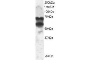 Image no. 1 for anti-Protein Phosphatase 2, Regulatory Subunit B', delta (PPP2R5D) (C-Term) antibody (ABIN374132) (PPP2R5D 抗体  (C-Term))
