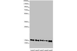 Western blot All lanes: ATP5F1D antibody at 2. (ATP5F1D 抗体  (AA 1-168))