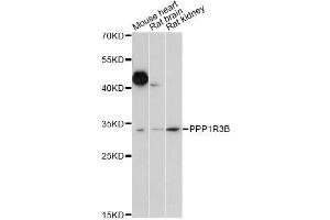 Western blot analysis of extracts of various cell lines, using PPP1R3B antibody (ABIN6293886) at 1:1000 dilution. (PPP1R3B 抗体)