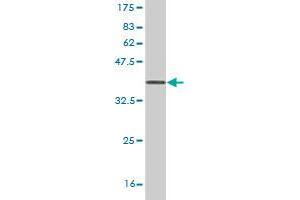 Western Blot detection against Immunogen (36. (UMPS 抗体  (AA 381-479))