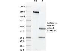 SDS-PAGE Analysis Purified CD44v4 Mouse Monoclonal Antibody (2F10). (CD44 抗体)